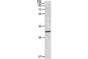 Western blot analysis of 293T cell, using MMP26 Polyclonal Antibody at dilution of 1:500 (MMP26 anticorps)