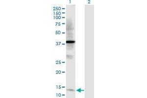 Western Blot analysis of TFF2 expression in transfected 293T cell line by TFF2 MaxPab polyclonal antibody. (Trefoil Factor 2 anticorps  (AA 1-129))