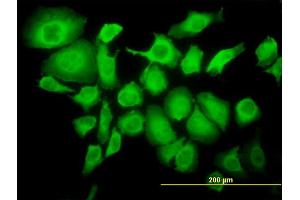 Immunofluorescence of monoclonal antibody to TRIM25 on HeLa cell. (TRIM25 anticorps  (AA 211-310))