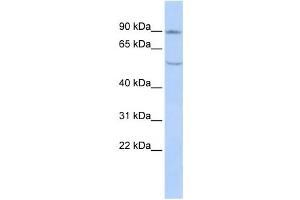 Western Blotting (WB) image for anti-Cadherin 4 (CDH4) antibody (ABIN2458919) (Cadherin 4 anticorps)