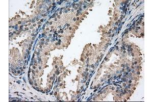Image no. 1 for anti-Proto-Oncogene Pim-2 (Serine Threonine Kinase) (PIM2) antibody (ABIN1500220)