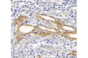 Immunohistochemistry analysis of paraffin-embedded rat kidney using,SPTBN2 (ABIN7075698) at dilution of 1: 2000