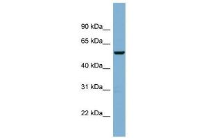 C2ORF29 antibody used at 1 ug/ml to detect target protein. (CNOT11 anticorps  (Middle Region))