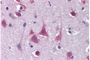 Human Brain, Cortex (formalin-fixed, paraffin-embedded) stained with MTO1 antibody ABIN294446 at 20 ug/ml followed by biotinylated goat anti-rabbit IgG secondary antibody ABIN481713, alkaline phosphatase-streptavidin and chromogen. (MTO1 anticorps  (C-Term))