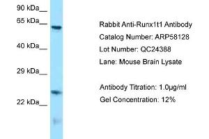 Western Blotting (WB) image for anti-Runt-Related Transcription Factor 1, Translocated To, 1 (Cyclin D-Related) (RUNX1T1) (N-Term) antibody (ABIN971644) (RUNX1T1 anticorps  (N-Term))
