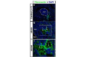 Immunohistochemical assessment of proteins involved in blood coagulation in ob/ob pancreata.