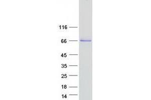 Validation with Western Blot