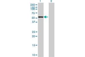 Western Blot analysis of LAP3 expression in transfected 293T cell line by LAP3 polyclonal antibody (A01).