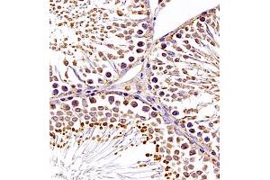 Immunohistochemistry of paraffin embedded rat testis using SRP14 (ABIN7075596) at dilution of 1:300 (400x lens) (SRP14 anticorps)