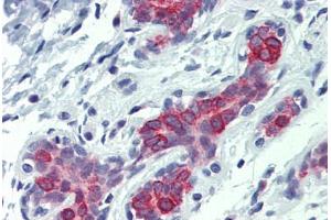 Human Breast: Formalin-Fixed, Paraffin-Embedded (FFPE)