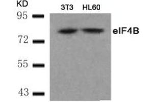 Image no. 2 for anti-Eukaryotic Translation Initiation Factor 4B (EIF4B) (AA 420-424) antibody (ABIN401568) (EIF4B anticorps  (AA 420-424))