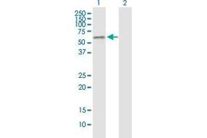 Western Blot analysis of GABPA expression in transfected 293T cell line by GABPA monoclonal antibody (M06), clone 5B6.