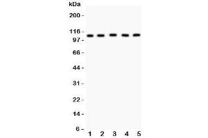 Western blot testing of MSH2 antibody and Lane 1:  mouse testis;  2: (m) skeletal muscle;  3: human HeLa;  4: (h) A549;  5: (h) SMMC-7721 lysate. (MSH2 anticorps  (AA 337-583))