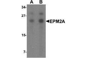 Western blot analysis of SW480 in SW480 cell lysate with EPM2A Antibody  at (A) 1 and (B) 2 μg/ml. (EPM2A anticorps  (C-Term))