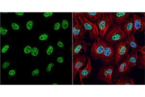 ICC/IF Image HMGB1 antibody detects HMGB1 protein at nucleus by immunofluorescent analysis. (HMGB1 anticorps)