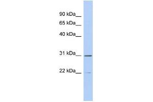 WB Suggested Anti-ZCCHC13 Antibody Titration: 0. (ZCCHC13 anticorps  (Middle Region))