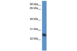 WB Suggested Anti-SLA2 Antibody Titration: 0.