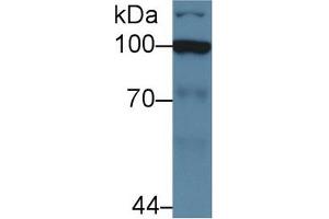 Western Blot; Sample: Human Jurkat cell lysate; Primary Ab: 5µg/ml Rabbit Anti-Human HK2 Antibody Second Ab: 0. (Hexokinase 2 anticorps  (AA 469-669))