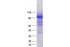 Validation with Western Blot