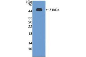 Detection of Recombinant ATF3, Human using Polyclonal Antibody to Activating Transcription Factor 3 (ATF3) (ATF3 anticorps  (AA 1-181))
