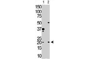 The HPCA polyclonal antibody  is used in Western blot to detect HPCA in Y79 cell lysate (Lane 1) and mouse brain tissue lysate (Lane 2) . (Hippocalcin anticorps  (N-Term))