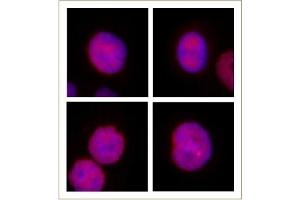 JMJD2B / KDM4B antibody (pAb) tested by Immunofluorescence. (KDM4B anticorps  (C-Term))
