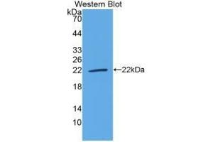 WB of Protein Standard: different control antibodies against Highly purified E. (IL-18 Kit ELISA)