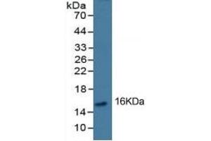 Mouse Capture antibody from the kit in WB with Positive Control: Human placenta tissue lysate.