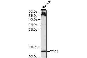 Western blot analysis of extracts of Rat liver, using CCL16 antibody (ABIN6291950) at 1:1000 dilution.