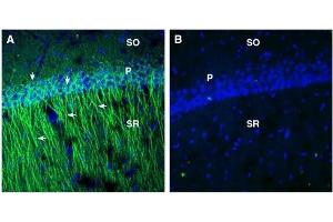 Expression of EphA2 in rat hippocampus. (EPH Receptor A2 anticorps  (Extracellular, N-Term))