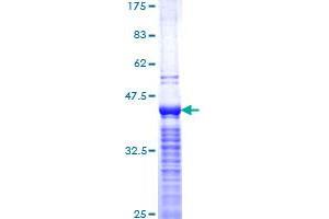 Image no. 1 for Antigen Identified By Monoclonal Antibody Ki-67 (MKI67) (AA 3157-3256) protein (GST tag) (ABIN1310965)