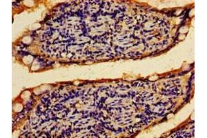 Immunohistochemistry of paraffin-embedded human small intestine tissue using ABIN7167505 at dilution of 1:100 (PTPRF anticorps  (AA 688-970))