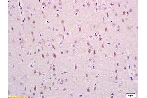 Formalin-fixed and paraffin embedded rat brain labeled with Anti phospho-NDEL1(Ser231) Polyclonal Antibody,Unconjugated (ABIN710801) at 1:200 followed by conjugation to the secondary antibody and DAB staining. (NDEL1 anticorps  (pSer231))
