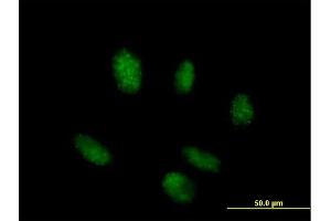 Immunofluorescence of purified MaxPab antibody to TINF2 on HeLa cell. (TINF2 anticorps  (AA 1-451))