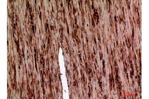 Immunohistochemistry (IHC) analysis of paraffin-embedded Human Colon, antibody was diluted at 1:100. (AAT (Internal Region) anticorps)