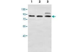 Western blot analysis of human fetal brain (Lane 1) and fetal lung (Lane 2) and fetal kidney (Lane 3) lysates with ZC3H11A polyclonal antibody  at 1 : 500 dilution. (ZC3H11A anticorps  (AA 332-585))