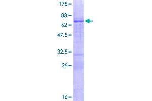 Image no. 1 for ALX Homeobox 1 (ALX1) (AA 1-326) protein (GST tag) (ABIN1344956)