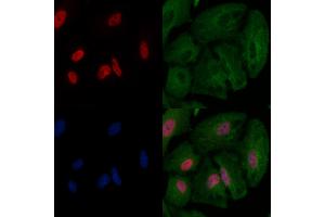 ABIN6263158 and ABIN6266586 staining  cells by IF/ICC.