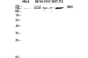 Western Blot (WB) analysis of HeLa KB SH-SY5Y 293T 3T3 lysis using Abl1 antibody. (ABL1 anticorps  (Ser120, Ser121))