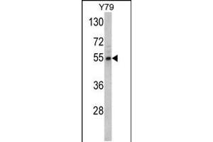 Western blot analysis of Fascin Antibody in Y79 cell line lysates (35ug/lane) (Fascin anticorps  (AA 322-350))
