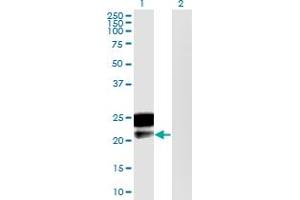 Western Blot analysis of DMRTB1 expression in transfected 293T cell line by DMRTB1 monoclonal antibody (M02), clone 5E7. (DMRTB1 anticorps  (AA 1-189))