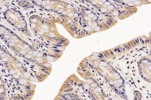 Immunohistochemistry analysis of paraffin-embedded rat rectum using,NME7 (ABIN7074918) at dilution of 1: 4200 (NME7 anticorps)