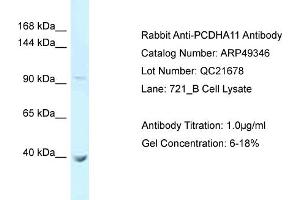 WB Suggested Anti-PCDHA11 Antibody   Titration: 1. (PCDHA11 anticorps  (N-Term))