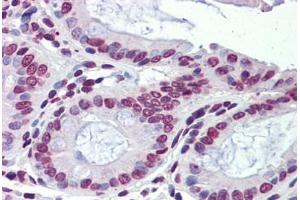 Human Colon (formalin-fixed, paraffin-embedded) stained with NR1H3 antibody ABIN462212 followed by biotinylated goat anti-rabbit IgG secondary antibody ABIN481713, alkaline phosphatase-streptavidin and chromogen.