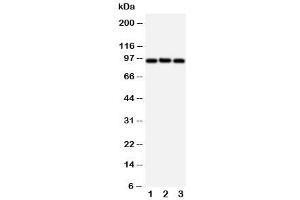 Western blot testing of ABCB6 antibody and Lane 1:  HeLa (ABCB6 anticorps  (C-Term))