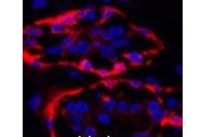 Immunofluorescence analysis of Human breast tissue using CK-17 Monoclonal Antibody at dilution of 1:200. (KRT17 anticorps)