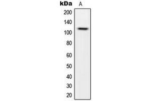 Western blot analysis of CARD14 expression in HeLa (A) whole cell lysates. (CARD14 anticorps  (Center))