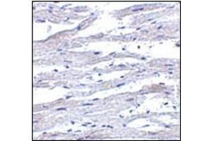 Immunohistochemistry of RIG-1 in human heart tissue with this product at 5 μg/ml. (DDX58 anticorps)