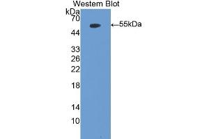 Detection of Recombinant MPO, Mouse using Polyclonal Antibody to Myeloperoxidase (MPO)