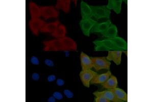 ABIN6258546 and ABIN6275024 staining Hela cells(24h of starvation treatment) by IF/ICC.
